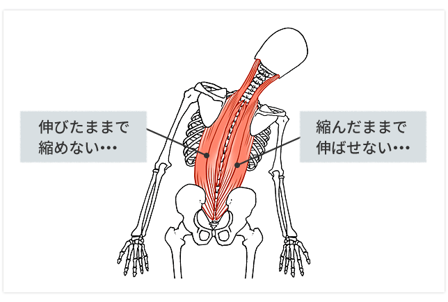 伸ばせない筋肉の図解